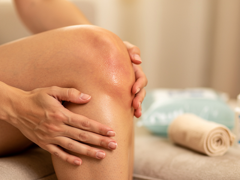 manage-knee-pain-swelling-causes-treatments-and-when-to-seek-help