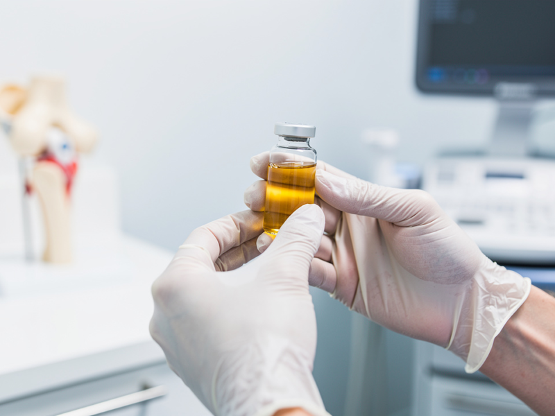 master-knee-prp-injection-procedure-benefits-and-risks-explained
