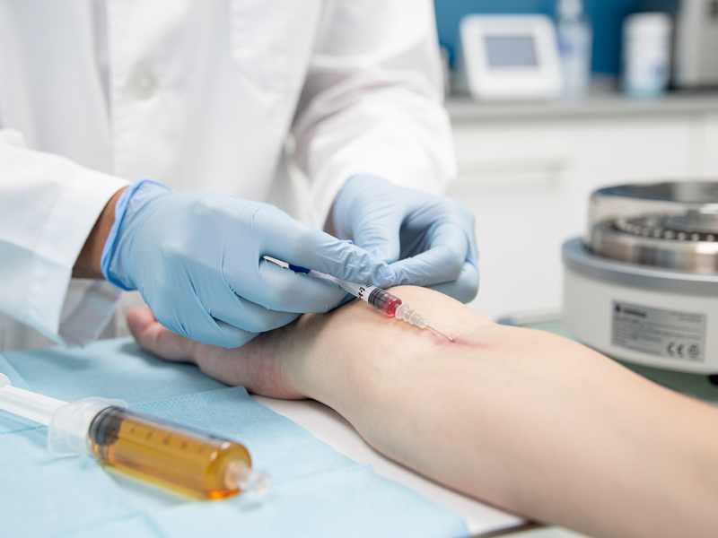 master-prp-for-knee-arthritis-benefits-candidates-and-process