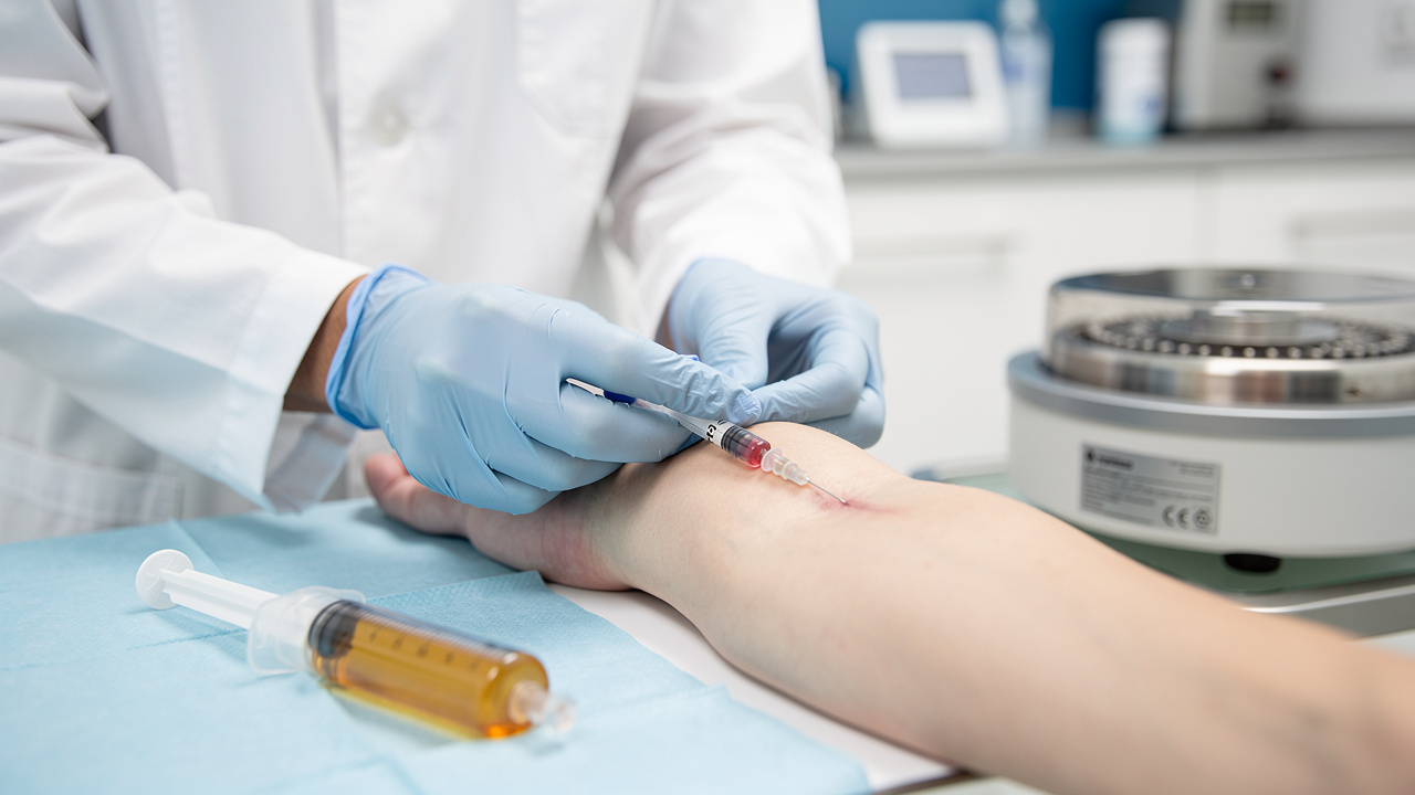 master-prp-for-knee-arthritis-benefits-candidates-and-process